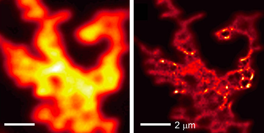 Comparison of images taken by a light microscope without the hyperbolic metamaterial (left) and with the hyperbolic metamaterial (right): quantum dots. (Image: University of California San Diego)