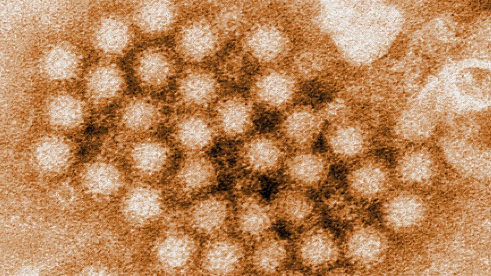 A digitally-colorized, transmission electron microscopic (TEM) image of individual norovirus particles (Image: CDC/ Charles D. Humphrey)