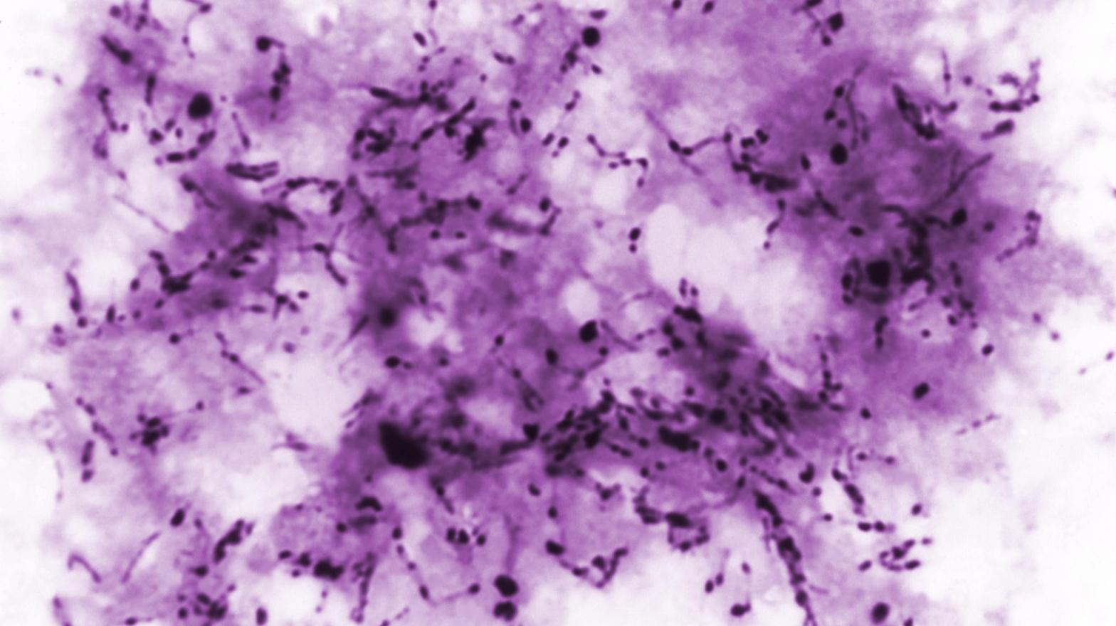 A photomicrograph of the rod-shaped bacteria Mycobacterium tuberculosis, responsible for its namesake disease. (Image: Elizabeth S. Mingioli/CDC)