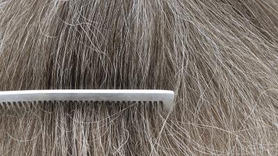 Reducing Stress Can Sometimes Reverse Grey Hair, Study Finds