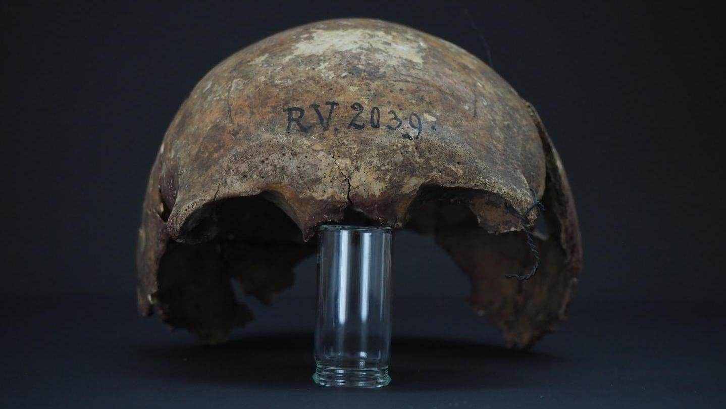 The skull of RV 2039,  a hunter-gatherer who died more than 5,000 years ago in what is today Latvia.  (Photo: Dominik Göldner, BGAEU, Berlin)