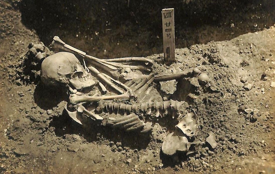 Original excavation photograph of Tsukumo No. 24. The man died after being attacked by a shark or sharks, according to a new analysis of his injuries. (Photo: Laboratory of Physical Anthropology, Kyoto University)