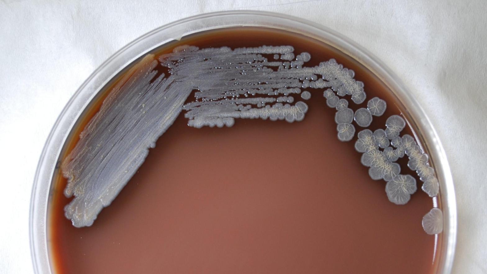 A photo of Burkholderia pseudomallei cultured in chocolate agar after three days time (Photo: Todd Parker/CDC)
