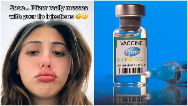 Exclusive: TGA Responds To TikTok Theory That Pfizer Causes Lip Filler Swelling