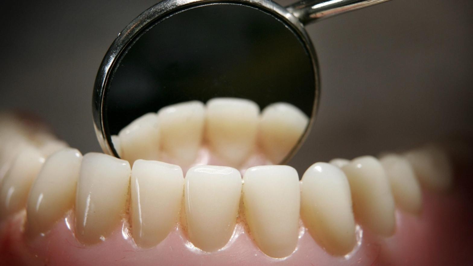 Teeth on a model denture set are reflected in a dental mirror on April 19, 2006 in Great Bookham, England. (Photo: Peter Macdiarmid, Getty Images)