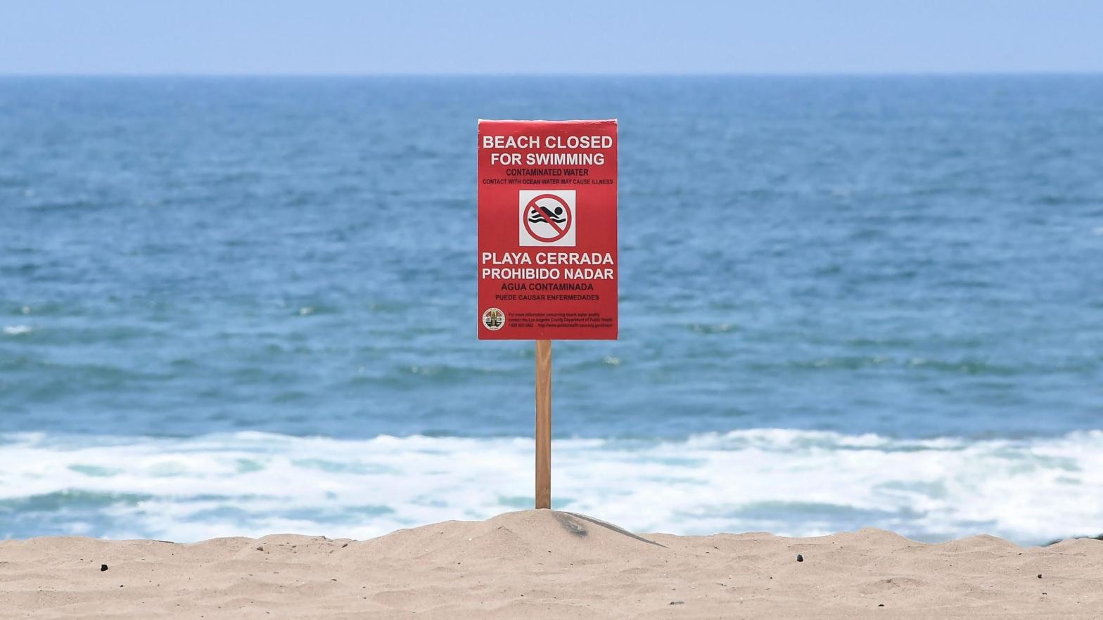 A sign indicates that the Dockweiler State Beach is closed to swimming after a sewage spill in Playa del Rey, in Los Angeles County, California. (Photo: Frederic J. Brown/AFP, Getty Images)