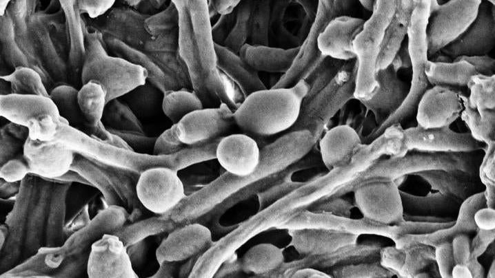 A scanning electron micrograph of Candida albicans in its more pathogenic, multicellular form. (Image: Vader 1941/University of Utah Health)