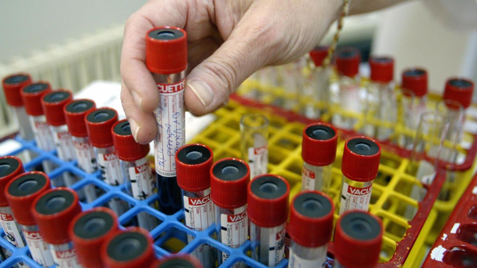 Samples being prepared for a blood test. (Photo: Attila Kisbenedek/AFP, Getty Images)