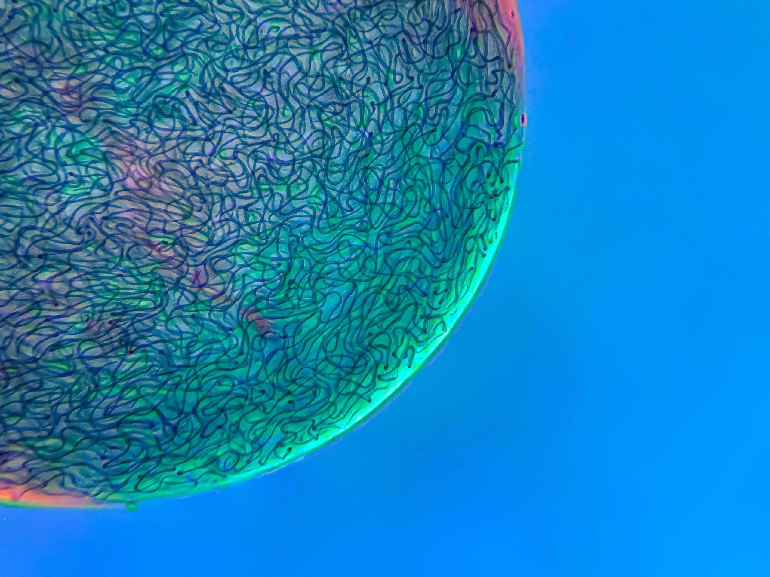 Strands of Nostoc cyanobacteria. (Image: Martin Kaae Kristiansen)