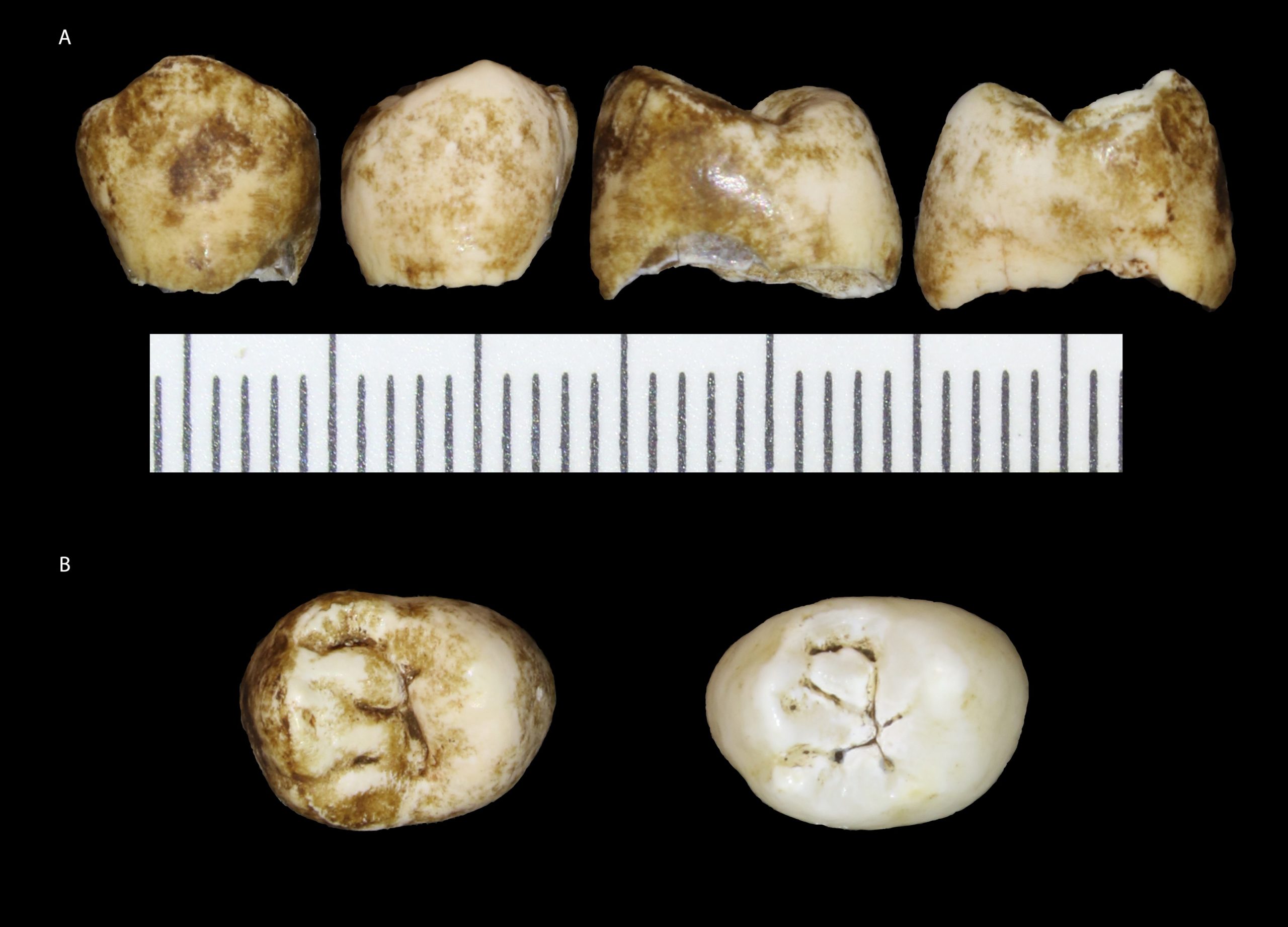 Multiple views of a molar belonging to the skull.  (Image: University of the Witwatersrand, Johannesburg.)