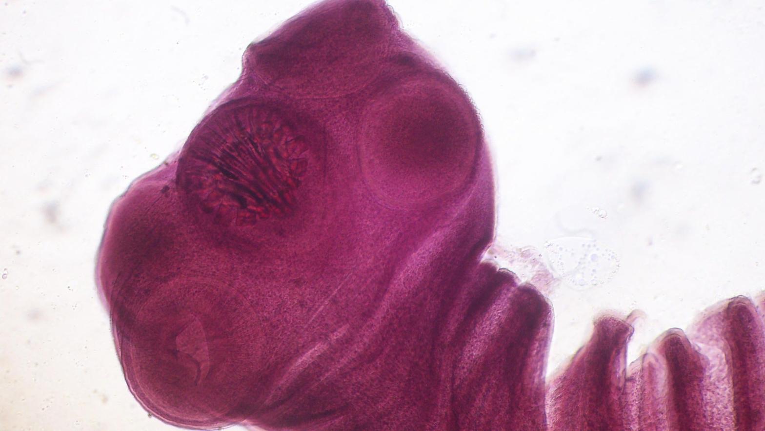 A close-up look at the scolex, or head, of a fully mature pork tapeworm. Interestingly enough, cysticercosis is what happens when the tapeworms don't get the chance to become adults. (Image: Roberto J. Galindo/Wikimedia Commons)
