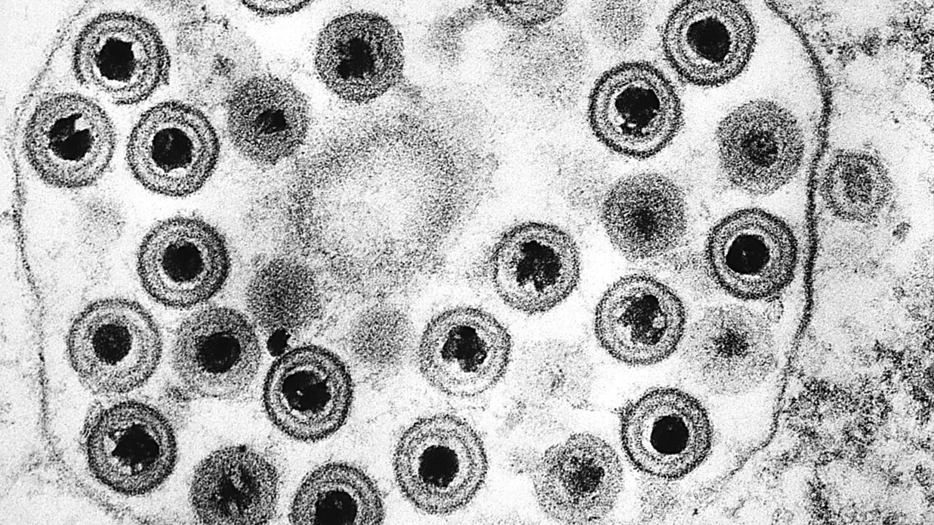 A transmission electron microscopic (TEM) image of many herpes simplex viruses.  (Image: CDC/Dr. Fred Murphy, Sylvia Whitfield)