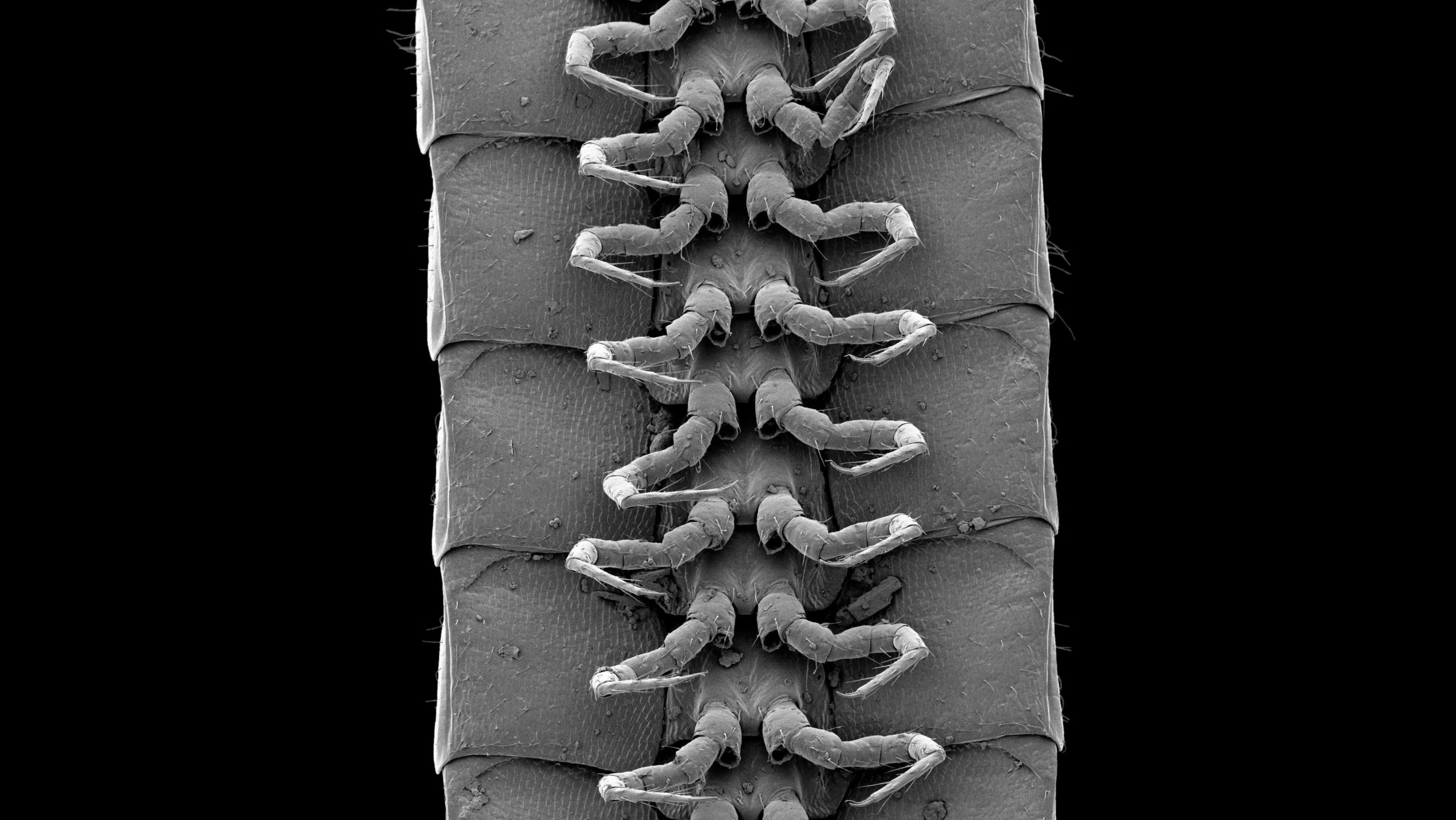 Some of the many legs on the newly discovered millipede. (Image: Marek et al., Scientific Reports 2021)