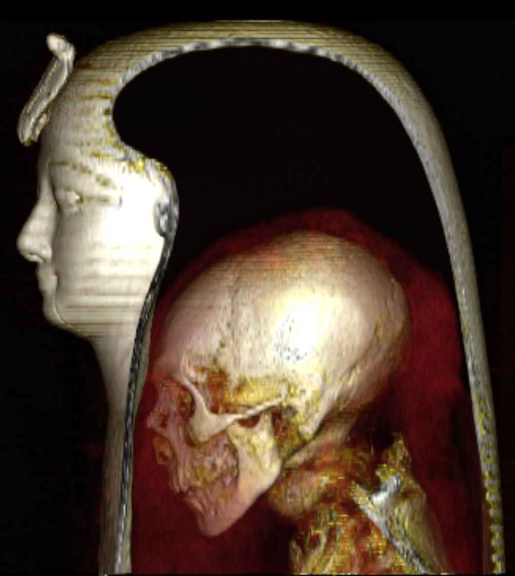 A CT scan of Amenhotep I's body inside its wrappings. (Image: Saleem et al., Frontiers in Medicine 2021)