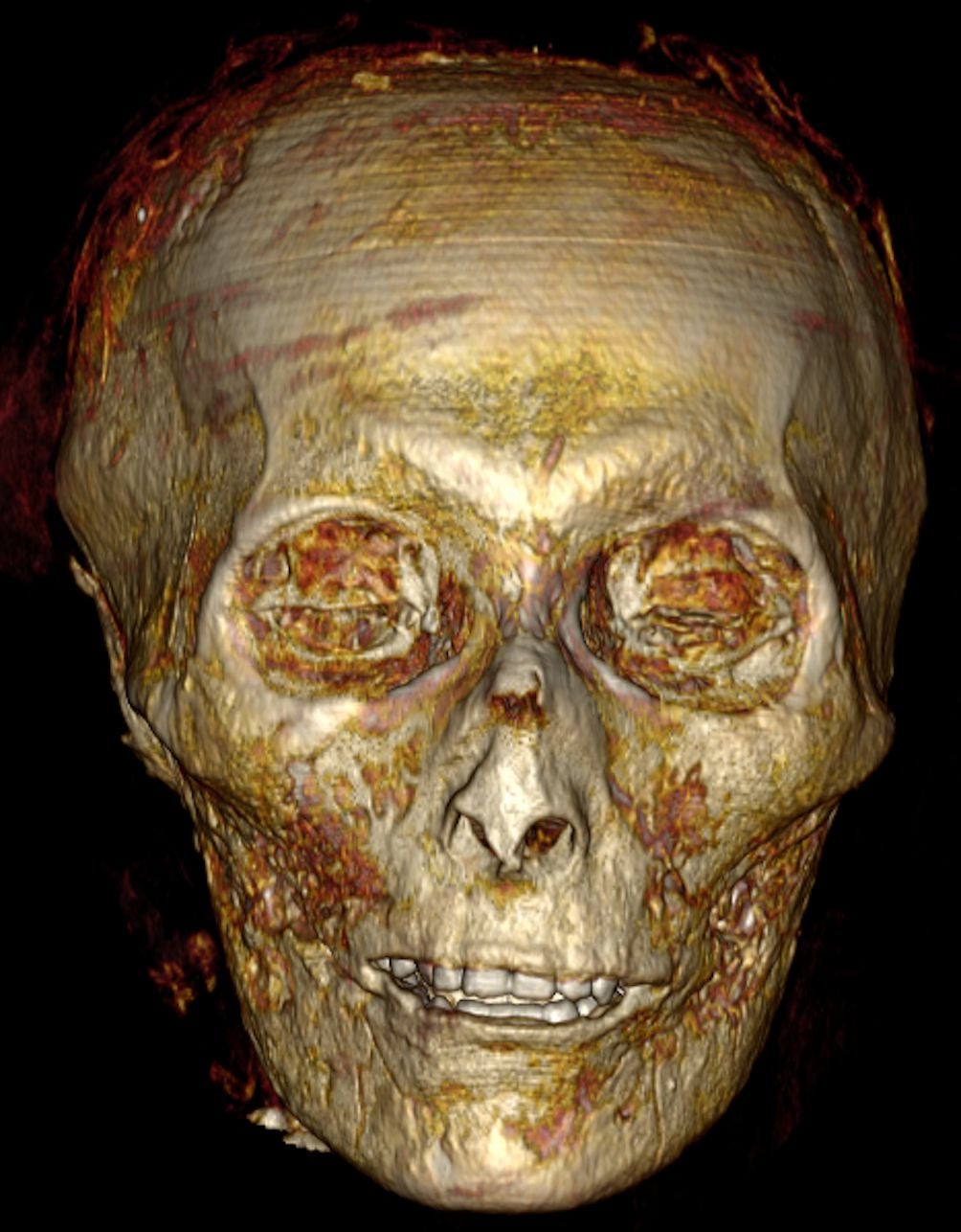 Digital Unwrapping of Pharaoh’s Mummy Reveals Curly Hair, Amulets, and Jewellery