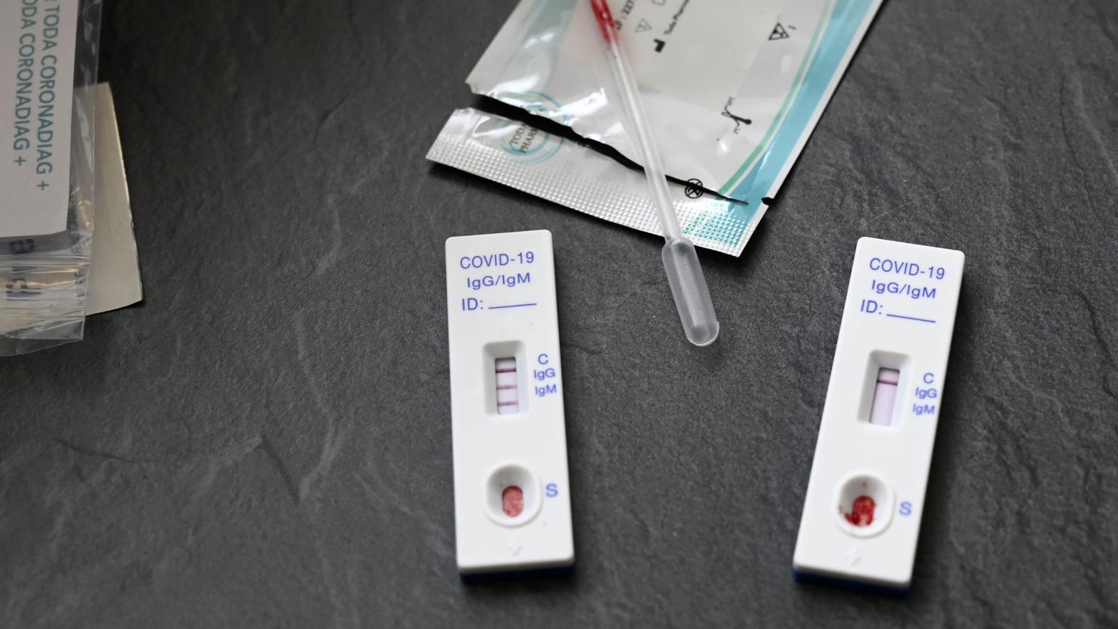 A positive (L) and a negative antibody test for covid-19 are pictured at a pharmacy in Strasbourg, eastern France, on July 15, 2020. (Photo: Frederick Florin/AFP, Getty Images)