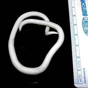 Parasitic Worms Found in Toilet of 2,700-Year-Old Mansion
