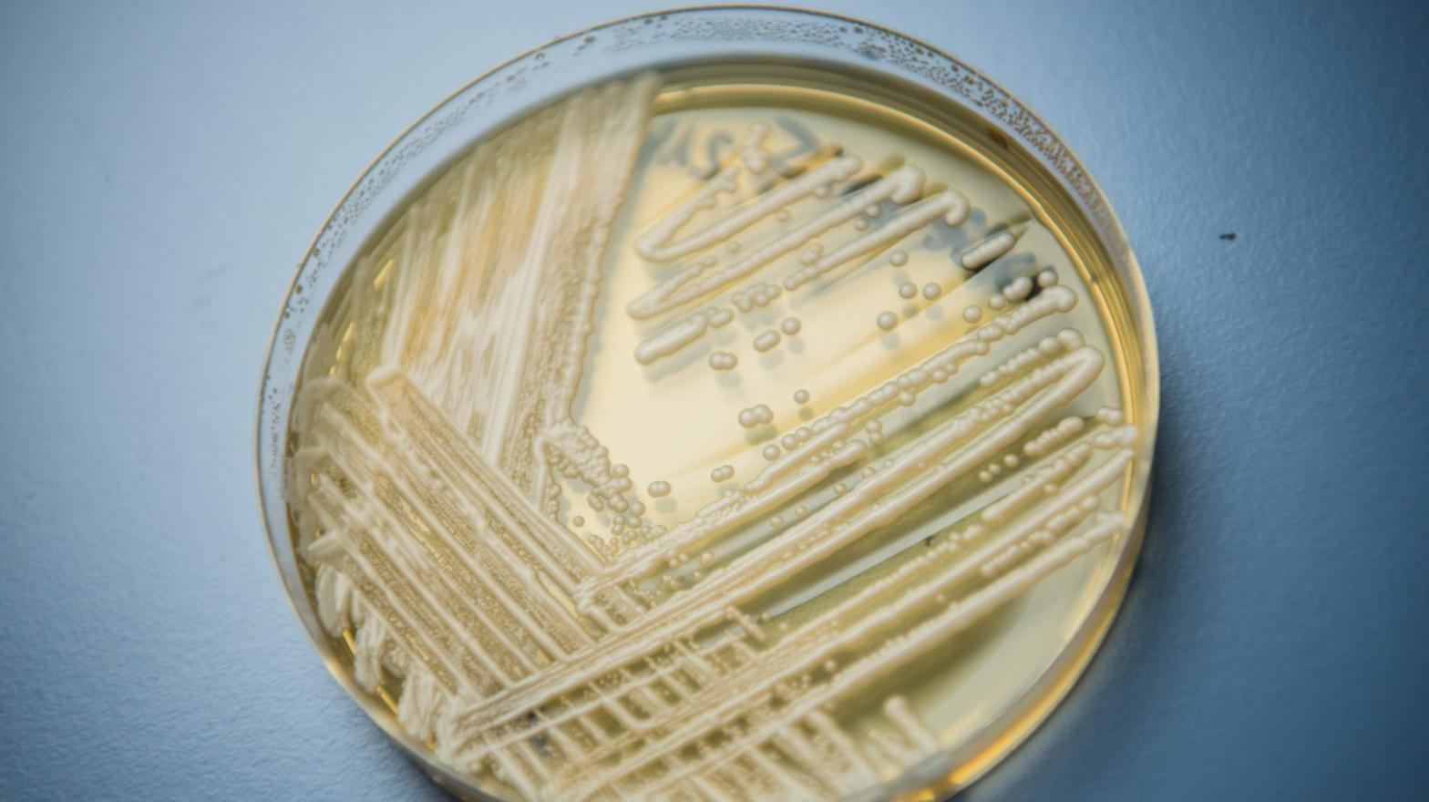 Candida auris in a petri dish. (Photo: Nicolas Armer/dpa, Getty Images)