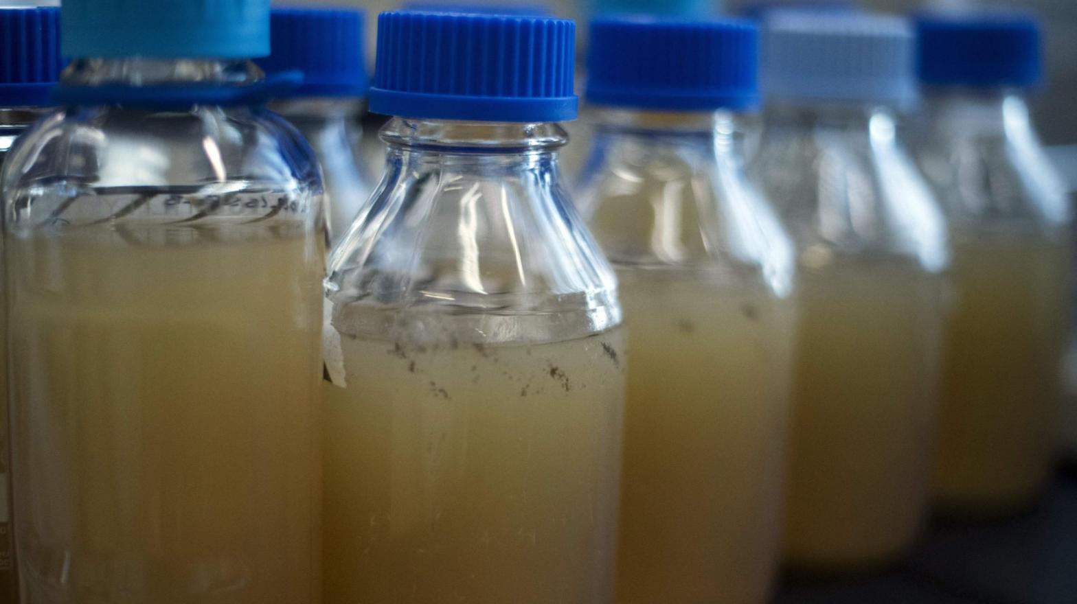 Medical bottles used to grow phages.  (Photo: Julien De Rosa/AFP, Getty Images)