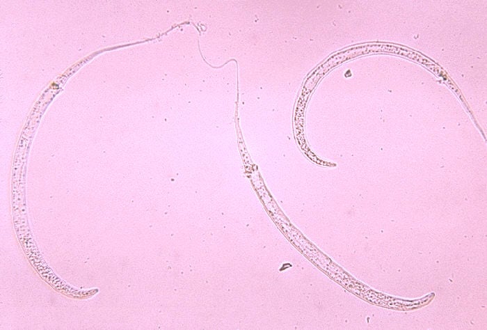 Dracunculus medinensis larvae (Image: CDC/Dr. Mae Melvin)