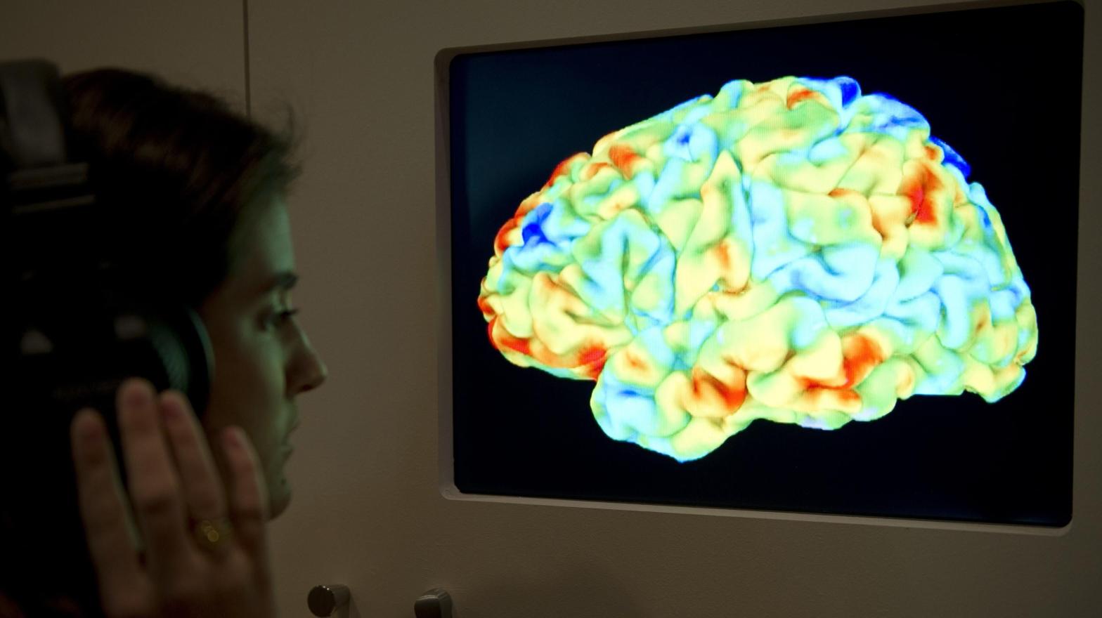 A woman looking at a functional magnetic resonance image (fMRI) . (Photo: Miguel Medina/AFP, Getty Images)