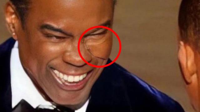 No, Chris Rock Wasn’t Wearing a Pad on His Cheek When Will Smith Slapped Him