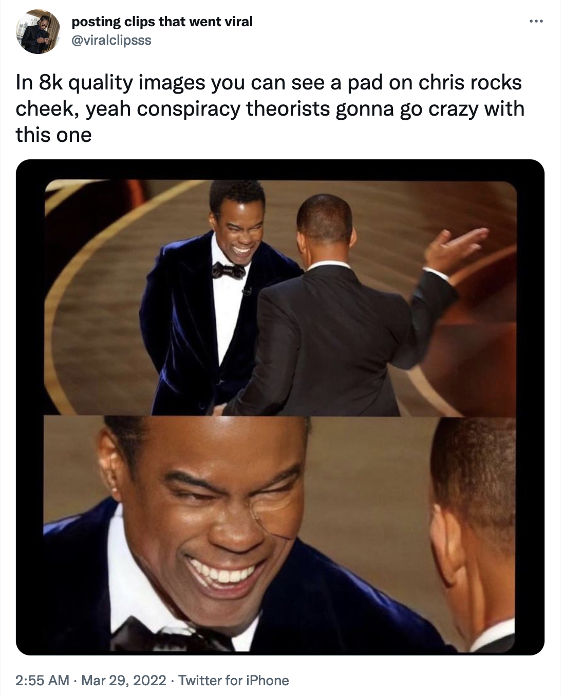 A viral image from Twitter purporting to show Chris Rock wearing a pad on his cheek before Will Smith slapped him. (Screenshot: Twitter)