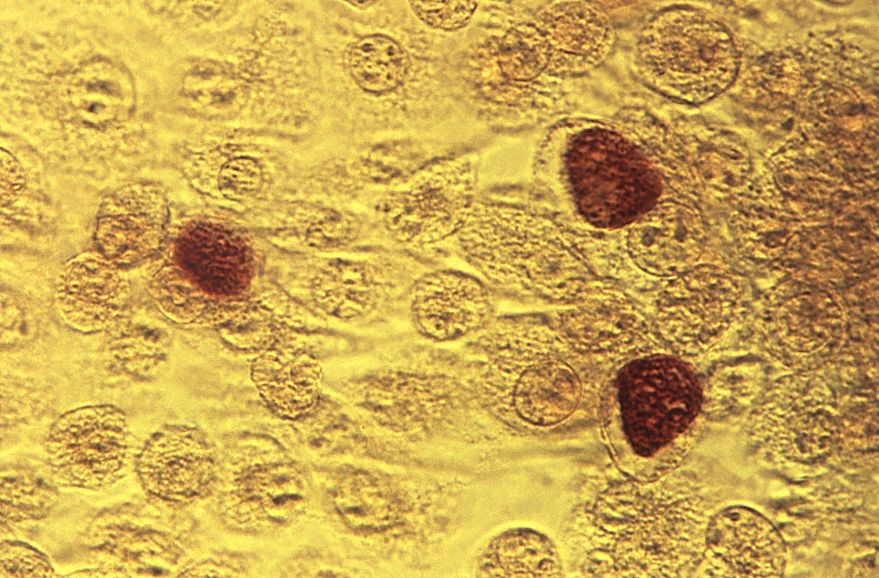 Chlamydia bacteria have a stage of life where they invade and live inside host cells, which can be seen above in the darker coloured circles. (Image: CDC/ Dr. E. Arum; Dr. N. Jacobs)