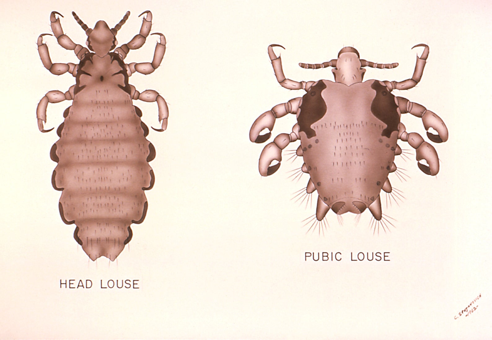 A comparison between head lice and the more crab-like pubic lice. (Illustration: CDC)