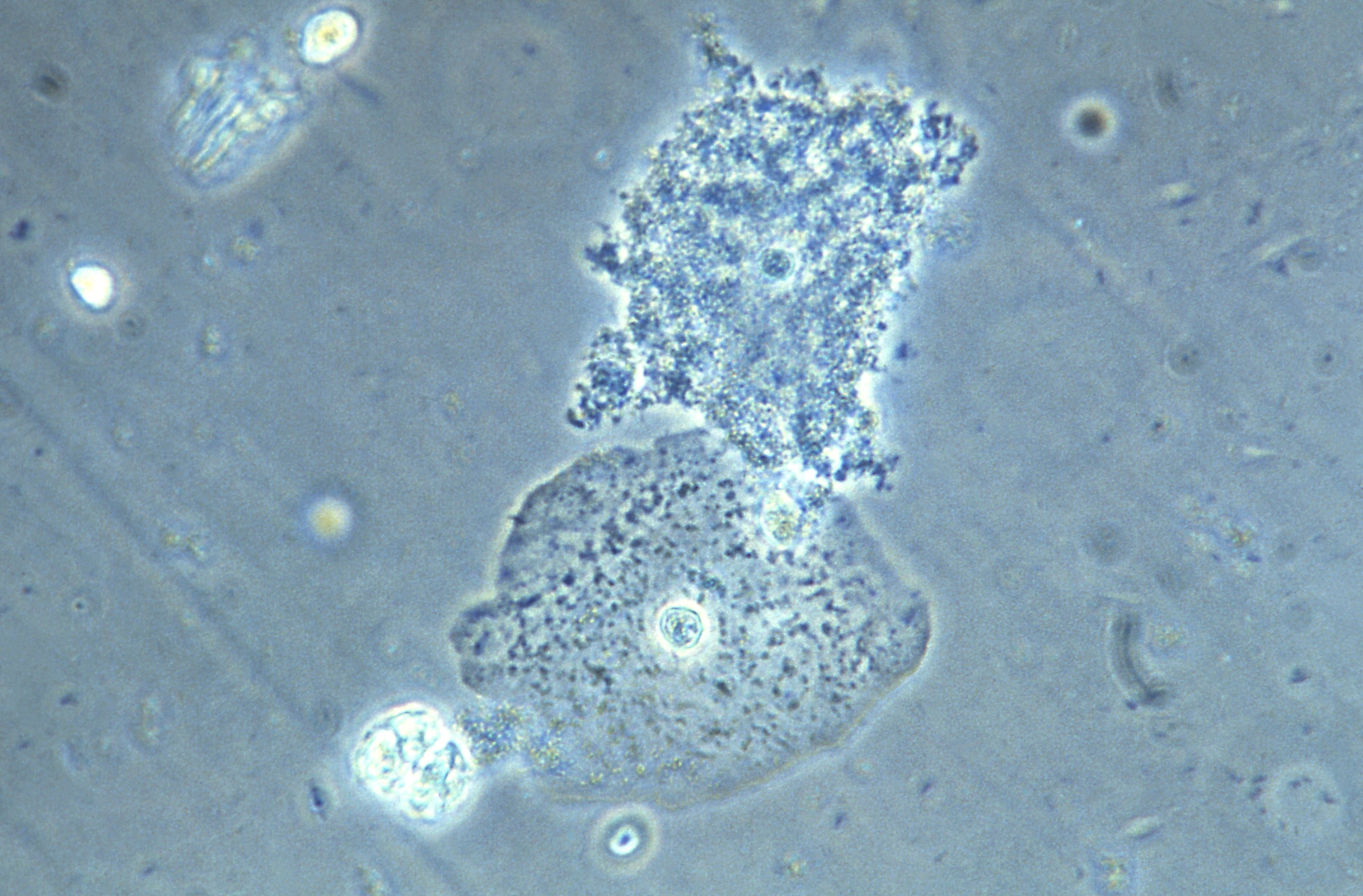 A micrograph of vaginal cells collected from someone showing signs of bacterial vaginosis. (Image: CDC/M. Rein)