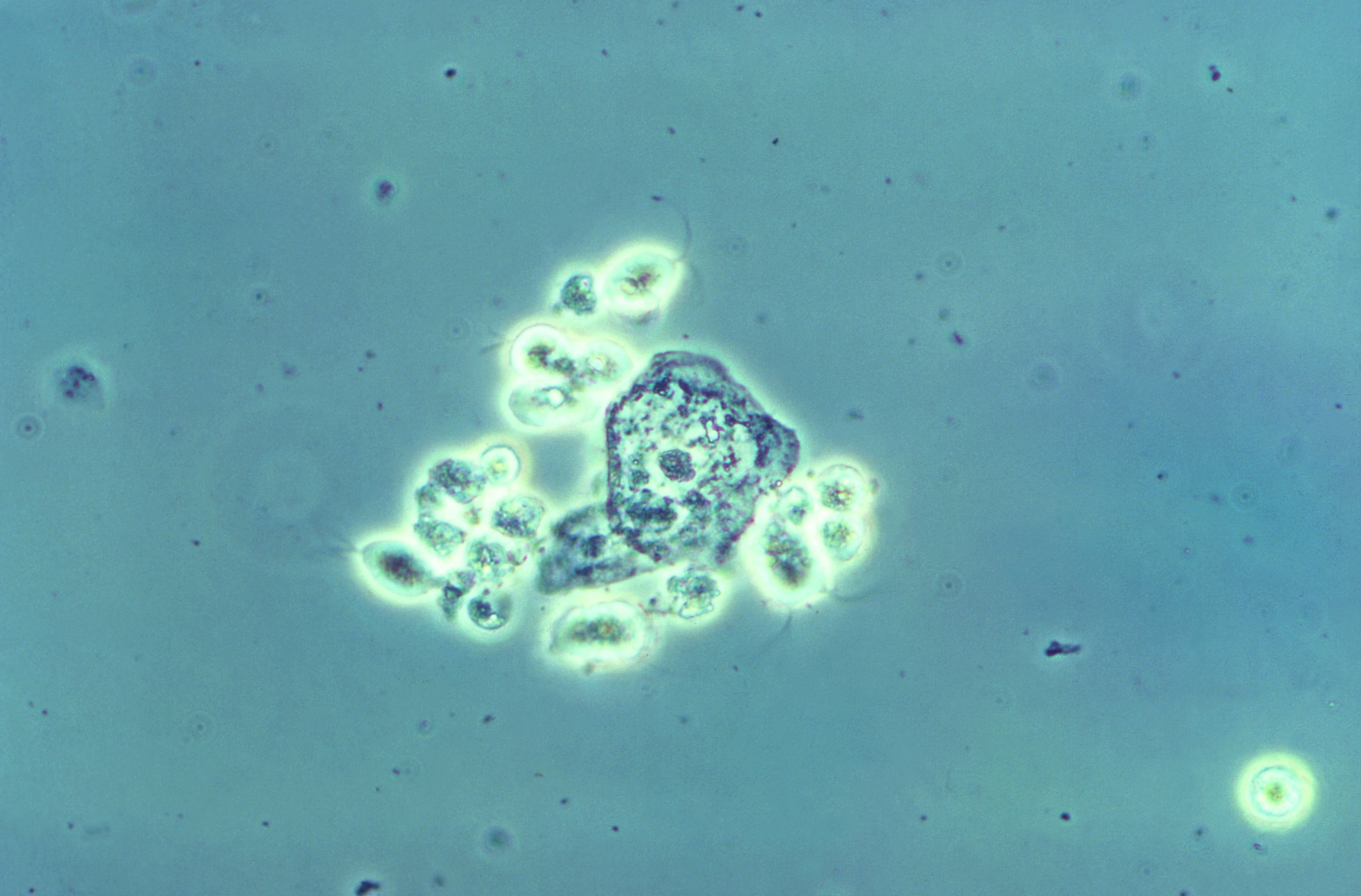 A group of Trichomonas vaginalis parasitic protozoa, collected from vaginal discharge. (Image: CDC/Joe Miller)