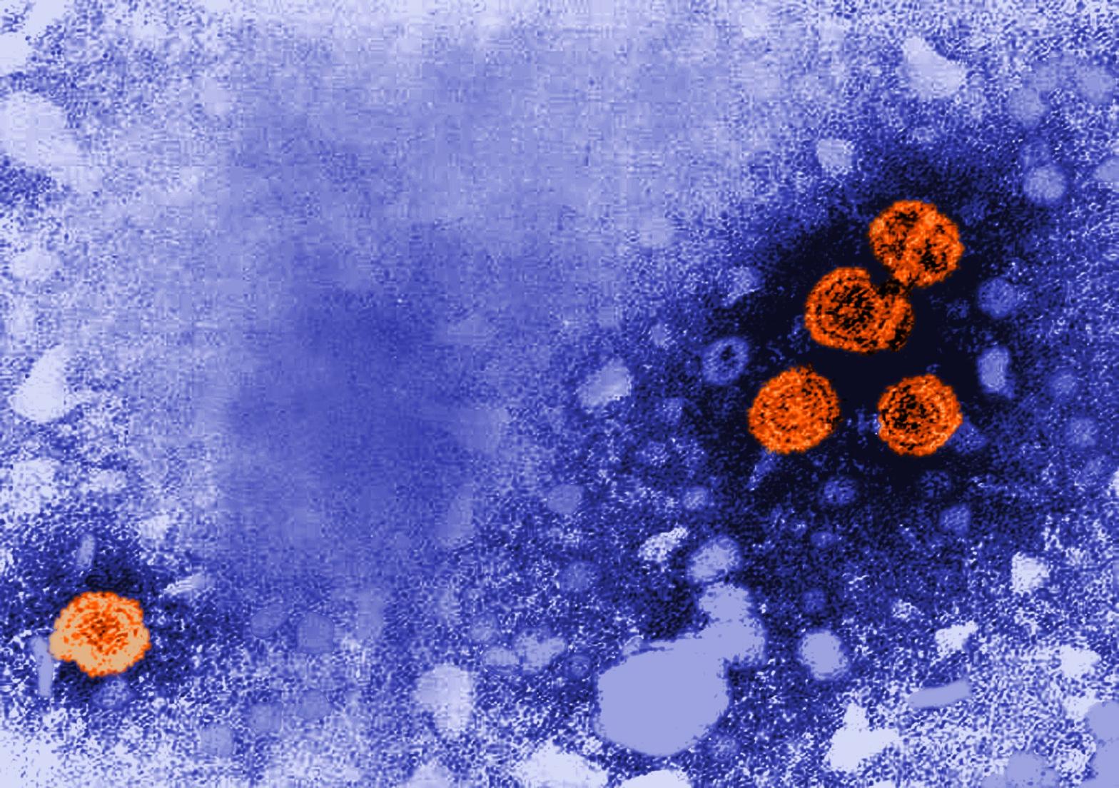 Hepatitis B particles, seen in orange under a transmission electron microscope. (Image: CDC/ Dr. Erskine Palmer)