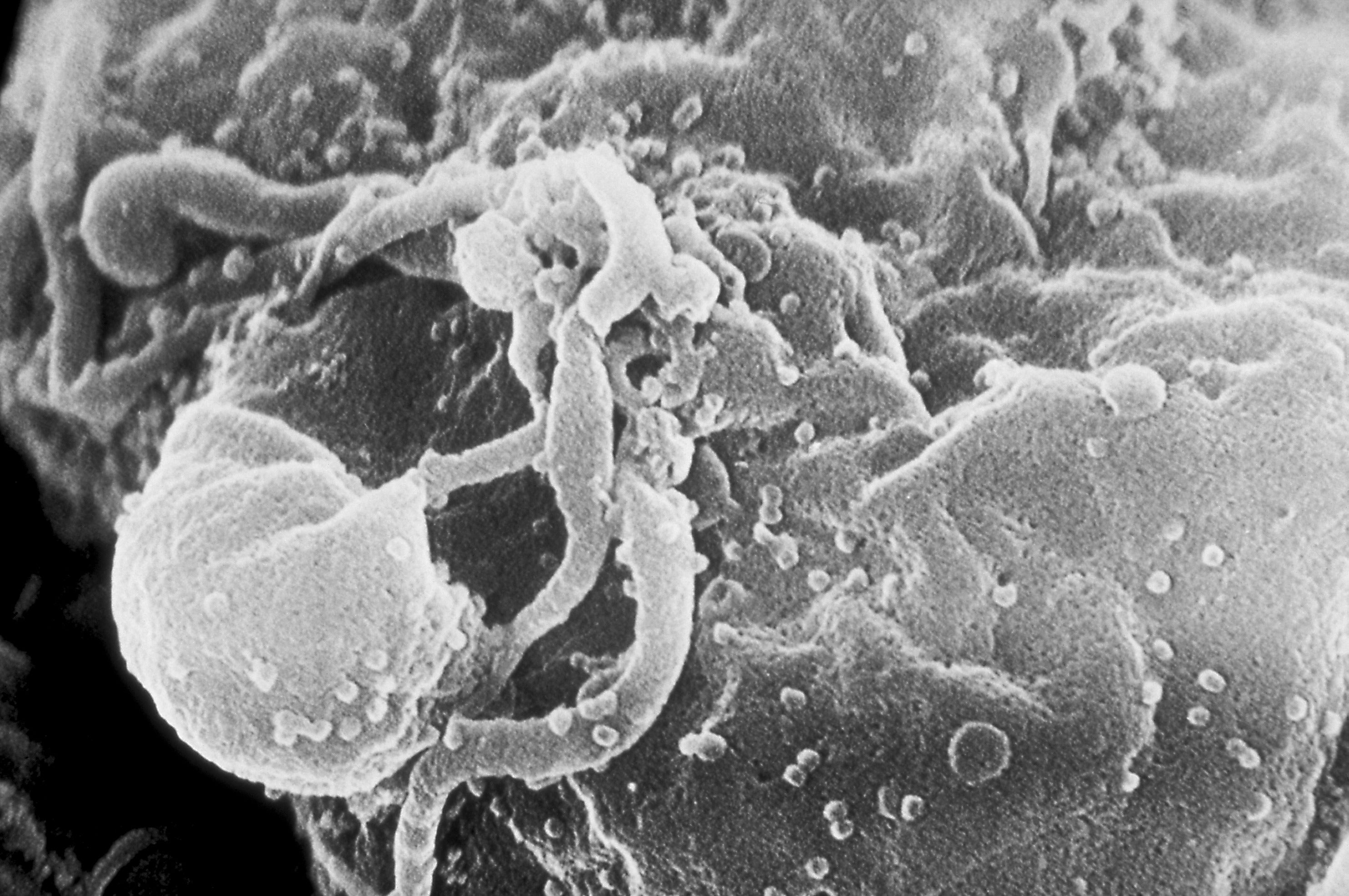 A scanning electron microscopic (SEM) image of (HIV-1) virions, seen as small round bumps. (Image: CDC/ C. Goldsmith)