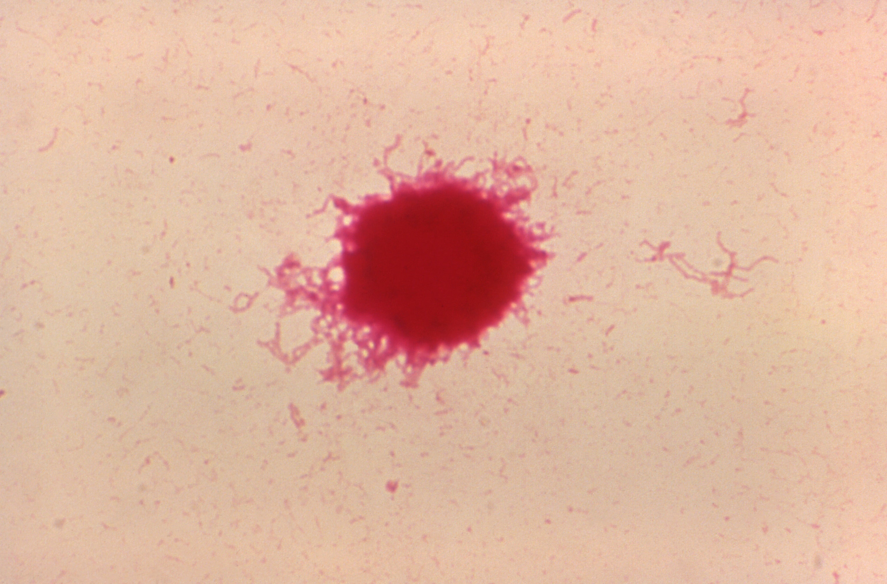 A clump of Haemophilus ducreyi bacteria found in a sample of rabbit blood (Image: CDC/Dr. Greg Hammond)