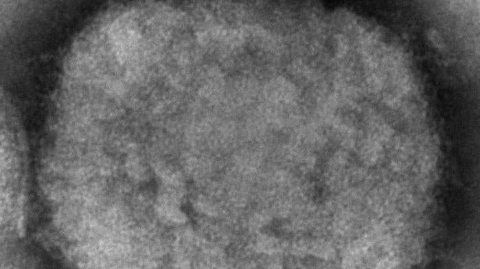 An electron microscope image of a single monkeypox virus. (Photo: Cynthia S. Goldsmith, Russell Regner/CDC via AP, AP)