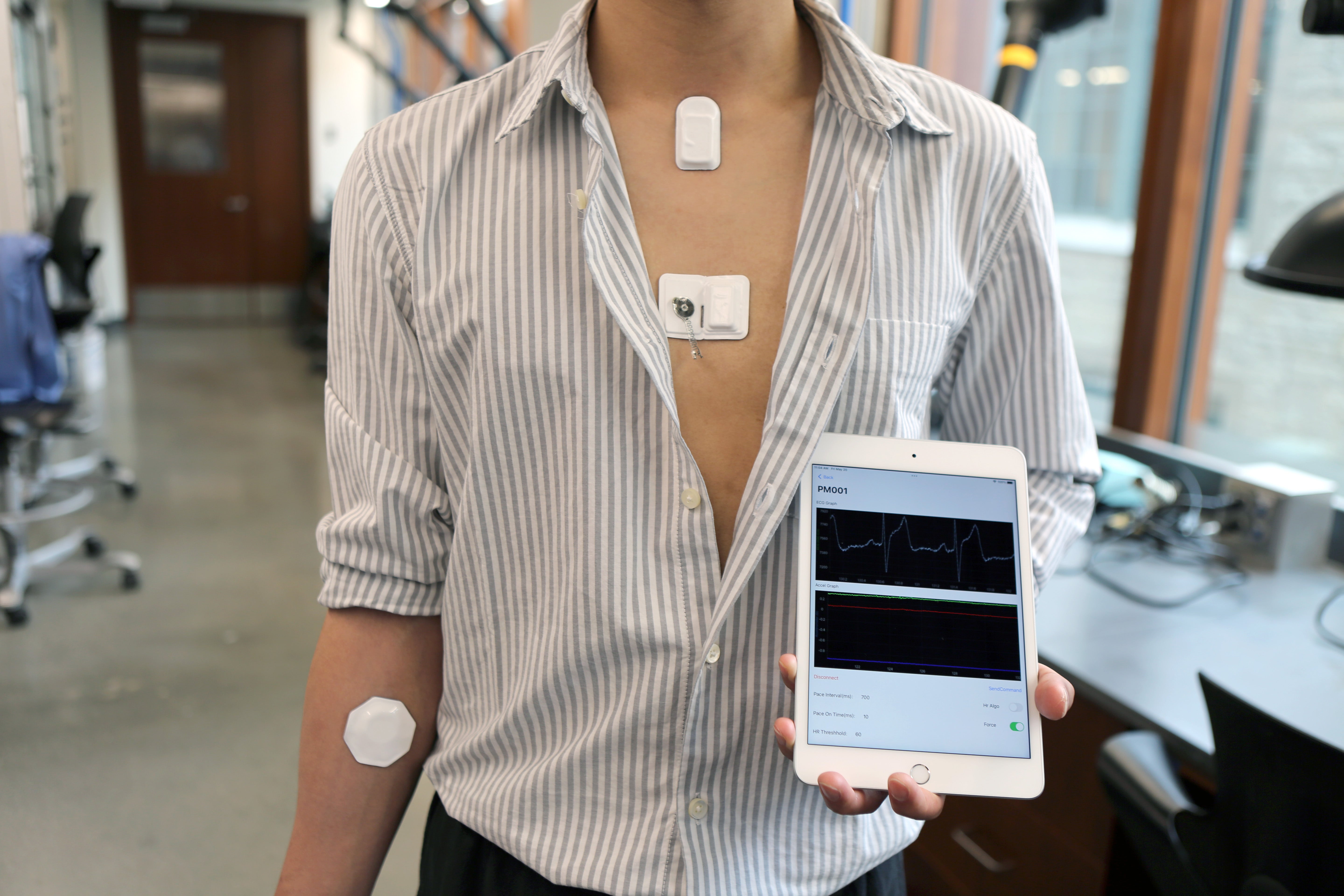 A volunteer demonstrating the updated pacemaker system's wireless sensors and control unit, which can also send data to an app seen on the tablet.  (Photo: Northwestern University)