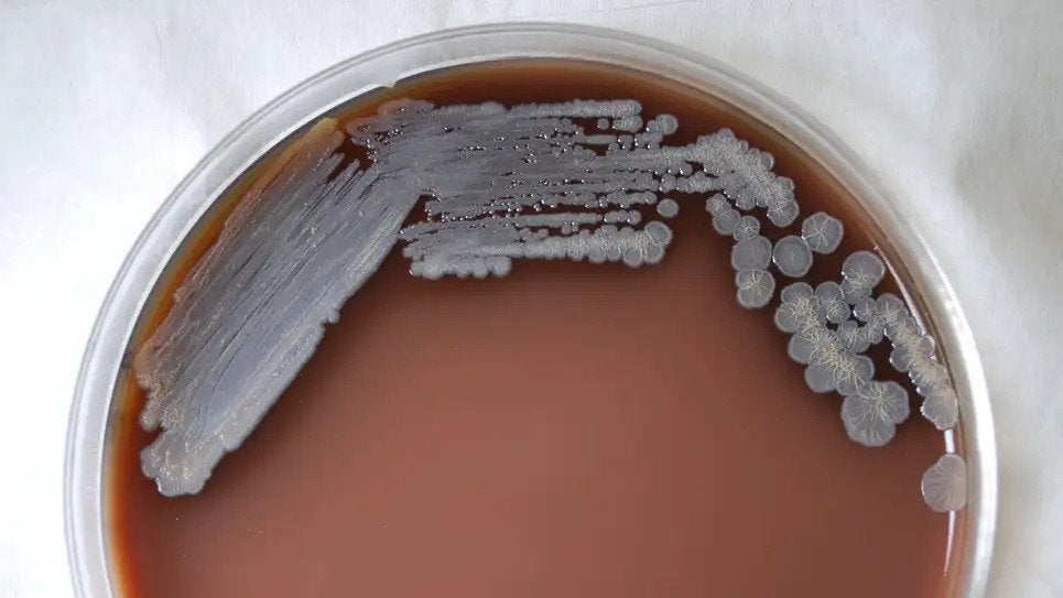 A photo of Burkholderia pseudomallei cultured in chocolate agar after three days time (Photo: Todd Packer/CDC)