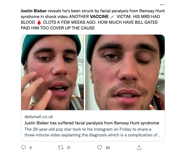 One of many posts on social media from anti-vaxxers falsely blaming Justin Bieber's illness on the covid-19 vaccine. (Screenshot: Jody Serrano / Gizmodo)
