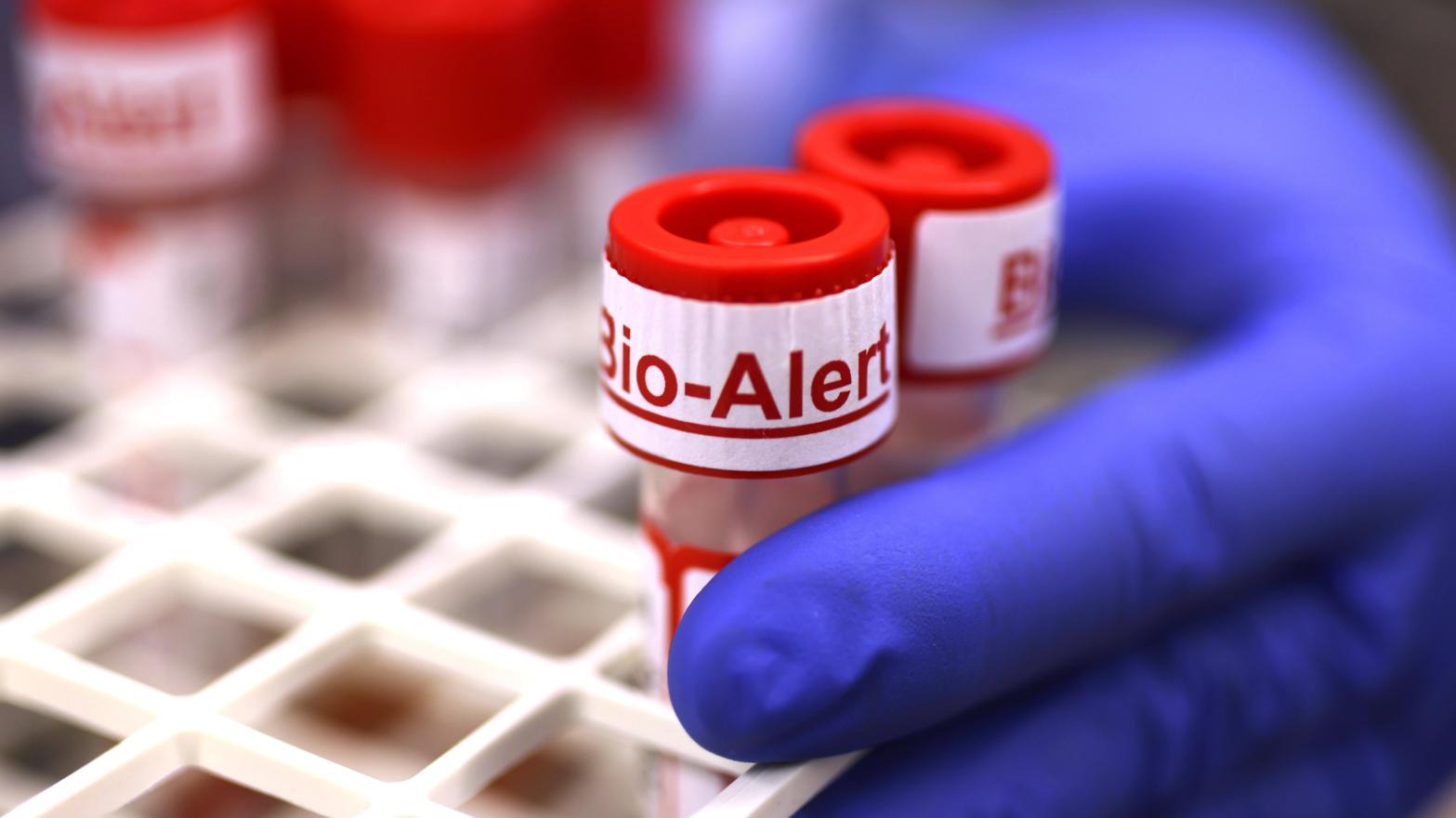 A swab specimen containing monkeypox virus is labelled 'Bio Alert' at the UW Medicine Virology Laboratory on July 12, 2022 in Seattle, Washington.  (Photo: Karen Ducey, Getty Images)