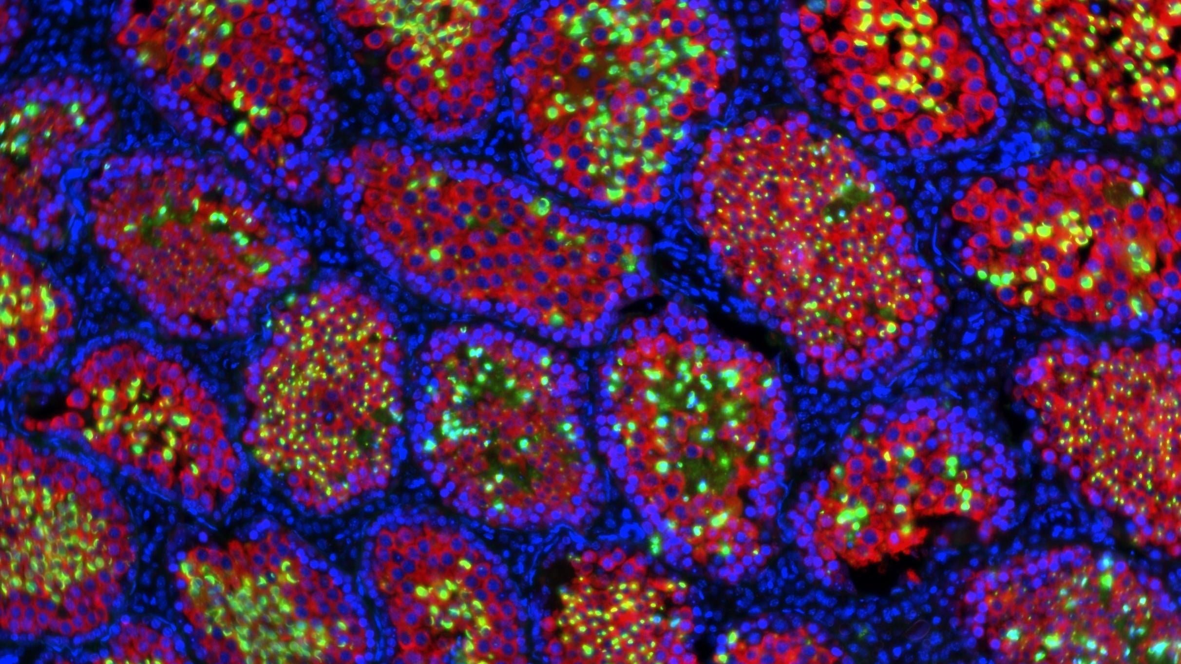 The testes of the mouse/rat hybrids seen up close using Immunofluorescence staining. The green and red spots mark the presence of sperm-associated proteins that otherwise would have been missing in sterile mice.  (Image: Joel Zvick/ETH Zurich)