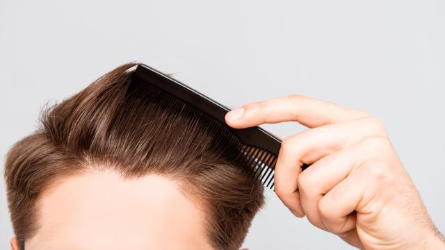 Scientists Are Working on New and Improved Hair Loss Treatments