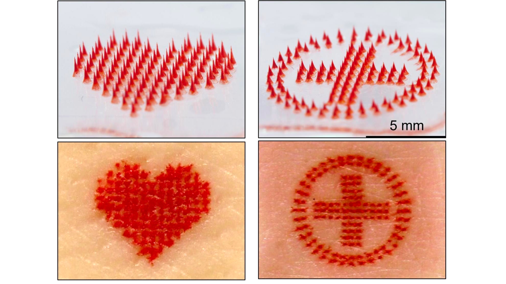 Painless Tattoos Might One Day Be a Thing Thanks to These Ink Filled Microscopic Needles