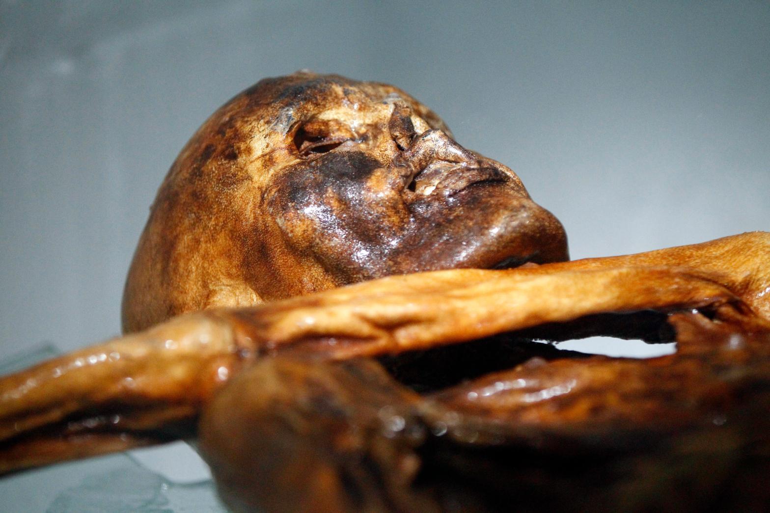 Ötzi, a 5,300-year-old mummy discovered in 1991. (Photo: Andrea Solero/AFP, Getty Images)
