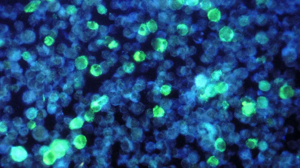 In green, leukemia cells infected by the Epstein-Barr virus. (Photo: CDC/ Dr. Paul M. Feorino)