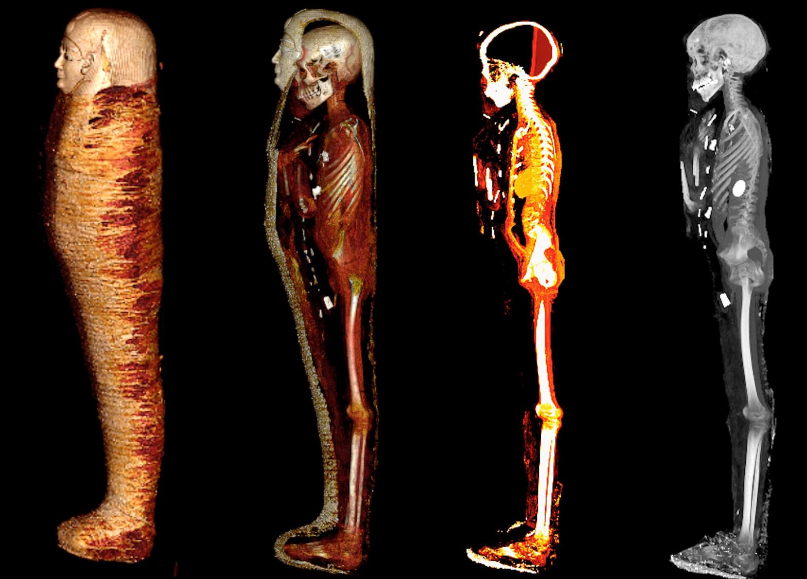 CT scans of the mummy revealed the boy's skeleton and amuluts (white spots on rightmost scan). (Image: SN Saleem, SA Seddik, M el-Halwagy)