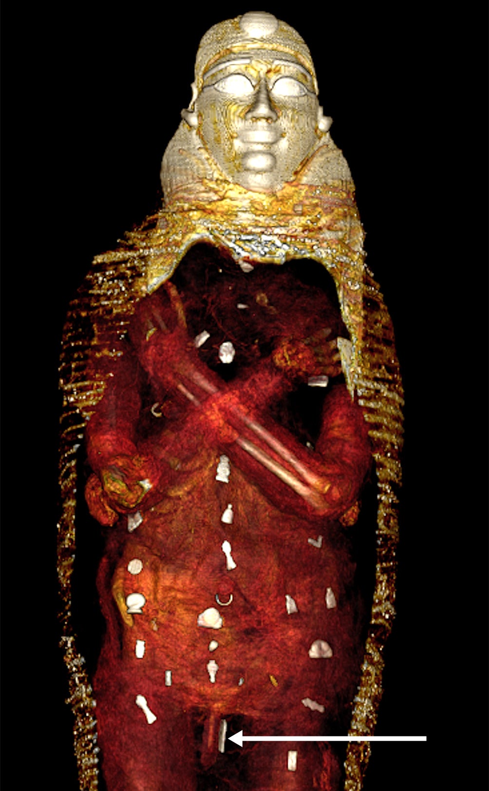 A CT scan reveals the amulets spread across the mummy, with a detail on the amulet on his penis. (Image: SN Saleem, SA Seddik, M el-Halwagy)