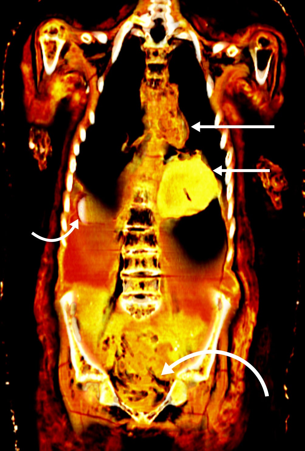 A CT scan of the mummy's abdominal cavity. (Image: SN Saleem, SA Seddik, M el-Halwagy)