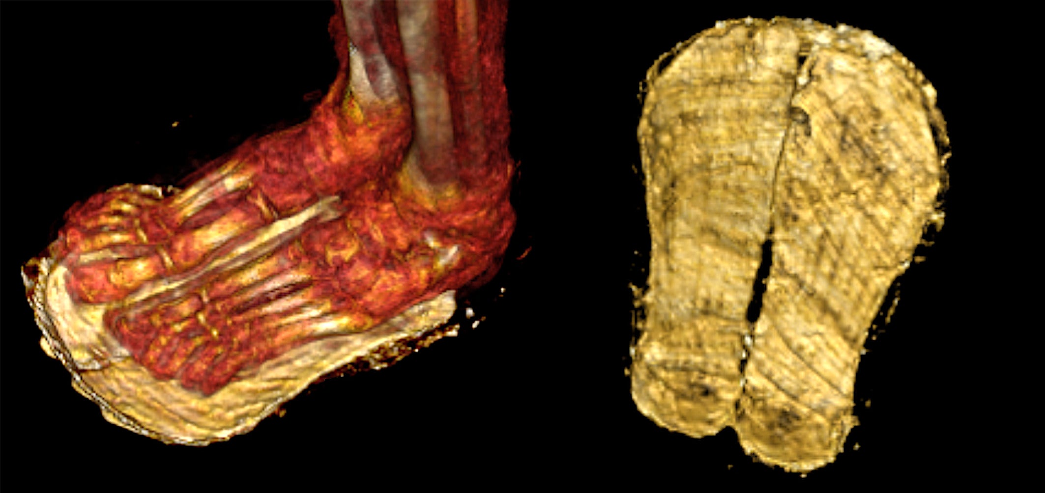 CT scans revealed sandals on the boy's feet. (Image: SN Saleem, SA Seddik, M el-Halwagy)