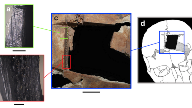 Bronze Age Brain Surgery: 3,500-Year-Old Skull Found With Square-Inch Hole