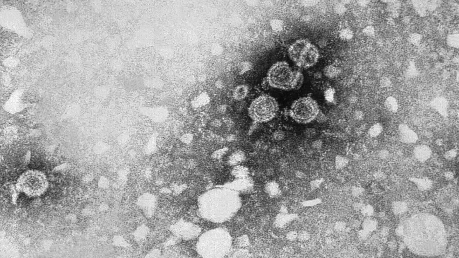 A transmission electron microscopic (TEM) image of hepatitis B virus (HBV) particles. (Image: Erskine Palmer/CDC)